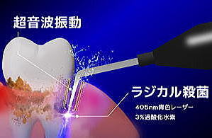 超音波振動　ラジカル殺菌